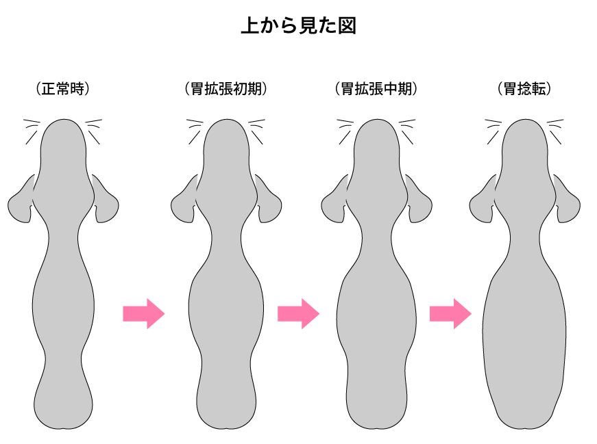 胃捻転の図